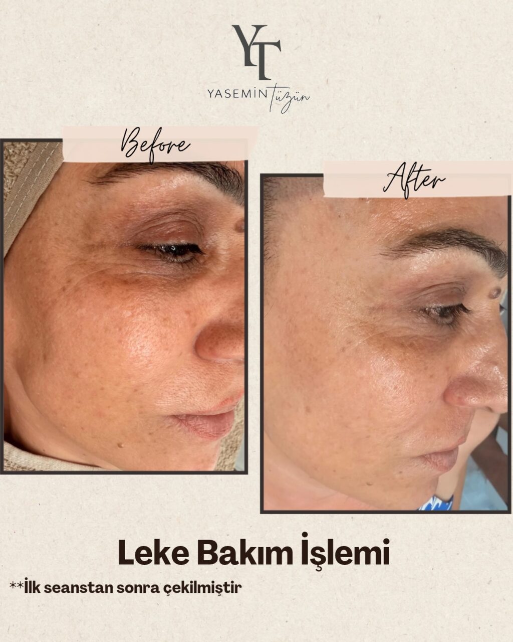Instagram post from yasemintuzun_mersin. This post is in position 6.