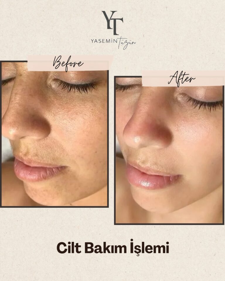 Instagram post from yasemintuzun_mersin. This post is in position 17.